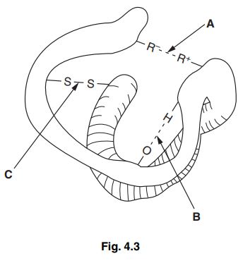 3D drawing of a protein, labelling bonds